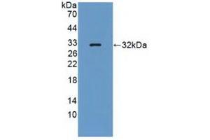 Detection of Recombinant PTPRQ, Human using Polyclonal Antibody to Protein Tyrosine Phosphatase Receptor Type Q (PTPRQ)