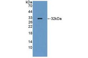 Detection of Recombinant PTPRQ, Human using Polyclonal Antibody to Protein Tyrosine Phosphatase Receptor Type Q (PTPRQ) (PTPRQ anticorps  (AA 36-294))