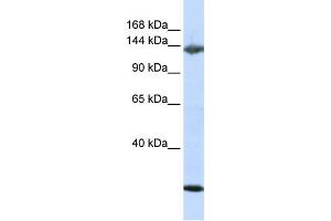 Western Blotting (WB) image for anti-Jagged 2 (JAG2) antibody (ABIN2458924) (JAG2 anticorps)
