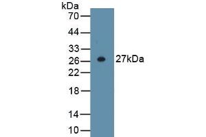 Detection of Recombinant ACTa2, Human using Anti-Actin Alpha 2, Smooth Muscle (ACTa2) Polyclonal Antibody