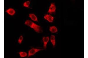 ABIN6278603 staining HeLa by IF/ICC. (OR1D4/5 anticorps)