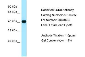 Western Blotting (WB) image for anti-Creatine Kinase, Brain (CKB) (C-Term) antibody (ABIN970402) (CKB anticorps  (C-Term))