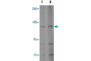 Western blot analysis of AP3B2 in rat brain tissue lysate with AP3B2 polyclonal antibody  at (1) 1 and (2) 2 ug/mL. (AP3B2 anticorps  (N-Term))