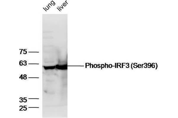 IRF3 anticorps  (pSer396)