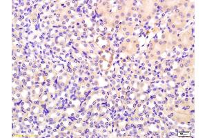 Formalin-fixed and paraffin embedded mouse kidney labeled with Rabbit Anti FGF1/AFGF Polyclonal Antibody, Unconjugated (ABIN726590) at 1:200 followed by conjugation to the secondary antibody and DAB staining (FGF1 anticorps  (AA 16-80))