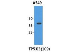 Image no. 1 for anti-Tumor Protein P53 Inducible Protein 3 (TP53I3) (AA 1-332), (N-Term) antibody (ABIN1109286) (TP53I3 anticorps  (N-Term))