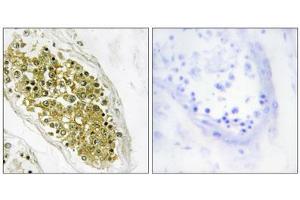 Immunohistochemistry analysis of paraffin-embedded human testis tissue using HIPK4 antibody.
