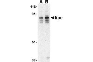 Western Blotting (WB) image for anti-Lipase, Hormone-Sensitive (LIPE) (C-Term) antibody (ABIN1030485) (LIPE anticorps  (C-Term))