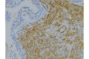 ABIN6273324 at 1/100 staining Human uterus tissue by IHC-P.