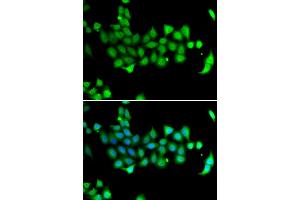 Immunofluorescence analysis of A549 cells using HSPA14 antibody.