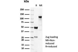 SDS-PAGE Analysis Purified TUBB3 Recombinant Rabbit Monoclonal Antibody (TUBB3/7089R). (Recombinant TUBB3 anticorps  (AA 437-450))