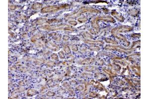 IHC analysis of NOV/CCN3 using anti-NOV/CCN3 antibody . (NOV anticorps  (C-Term))