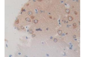 Used in DAB staining on fromalin fixed paraffin- embedded lung tissue