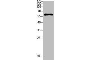 Western Blot analysis of mouse-kidney cells using Antibody diluted at 1000 (FBXO7 anticorps  (AA 371-420))