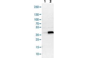 Western blot analysis of Lane 1: NIH-3T3 cell lysate (Mouse embryonic fibroblast cells), Lane 2: NBT-II cell lysate (Rat Wistar bladder tumour cells) with ASB8 polyclonal antibody . (ASB8 anticorps)