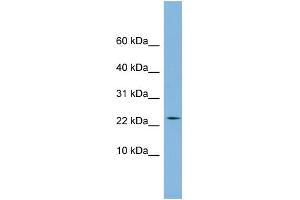 WB Suggested Anti-PPIL3 Antibody Titration:  0. (PPIL3 anticorps  (Middle Region))