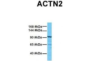 Host:  Rabbit  Target Name:  ACTN2  Sample Tissue:  Human PANC1  Antibody Dilution:  1.