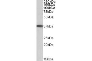 ABIN571230 (0. (MOGAT2 anticorps  (Internal Region))