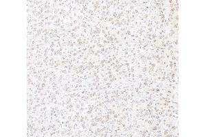 Immunohistochemistry (IHC) image for anti-Mediator Complex Subunit 12 (MED12) (C-Term) antibody (ABIN7453548) (MED12 anticorps  (C-Term))