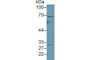 Western Blot; Sample: Human Jurkat cell lysate; Primary Ab: 2µg/ml Rabbit Anti-Human ABCD4 Antibody Second Ab: 0.