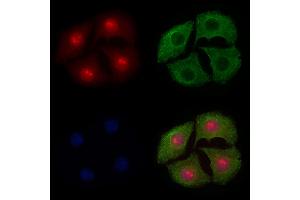ABIN6255069 and ABIN6267579 staining Hela cells(4h of LPS treatment) by IF/ICC. (FOXO4 anticorps  (pSer197))