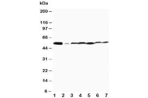 Western blot testing of MAPK8/9 antibody and Lane 1:  rat brain (MAPK8 / MAPK9 (Middle Region) anticorps)