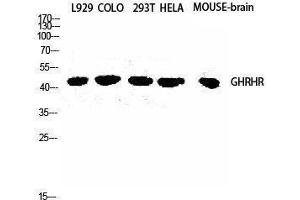 Western Blotting (WB) image for anti-Growth Hormone Releasing Hormone Receptor (GHRHR) (C-Term) antibody (ABIN3184788)