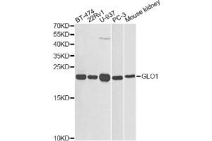 Western blot analysis of extracts of various cell lines, using GLO1 antibody (ABIN1872829) at 1:1000 dilution. (GLO1 anticorps)