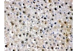 IHC testing of FFPE mouse liver with DDB1 antibody. (DDB1 anticorps  (AA 1011-1140))