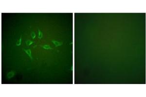 Immunofluorescence analysis of HepG2 cells, using NOS2 antibody (ABIN5976446). (NOS2 anticorps  (C-Term))
