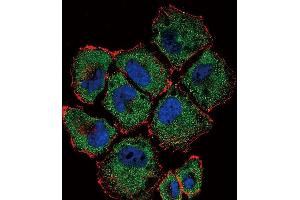 Confocal immunofluorescent analysis of SLC36A1 Antibody (N-term) (ABIN656104 and ABIN2845446) with NCI- cell followed by Alexa Fluor 488-conjugated goat anti-rabbit lgG (green).