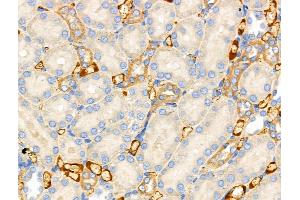 ABIN6257351 and ABIN6274731 at 1/100 staining Rat kidney tissue by IHC-P.