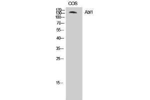 Western Blotting (WB) image for anti-C-Abl Oncogene 1, Non-Receptor tyrosine Kinase (ABL1) (Ser120), (Ser121) antibody (ABIN3183605) (ABL1 anticorps  (Ser120, Ser121))