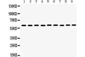 Western Blotting (WB) image for anti-Monoamine Oxidase B (MAOB) (AA 448-484), (C-Term) antibody (ABIN3043873)