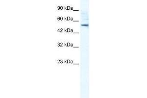 WB Suggested Anti-SMPDL3B Antibody Titration:  0. (SMPDL3B anticorps  (N-Term))