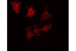ABIN6275787 staining HepG2 cells by IF/ICC. (SRCIN1 anticorps  (Internal Region))