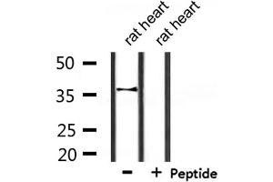 Western blot analysis of extracts from rat heart, using CACNG7 Antibody. (CACNG7 anticorps  (Internal Region))
