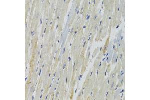 Immunohistochemistry of paraffin-embedded rat heart using AKT1S1 Antibody (ABIN1882365) at dilution of 1:100 (40x lens). (PRAS40 anticorps)