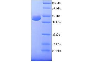 SDS-PAGE (SDS) image for RAD23 Homolog A (RAD23A) (AA 1-363), (full length) protein (His tag) (ABIN5713780)