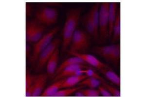 Immunofluorescenitrocellulosee of human HeLa cells stained with Hoechst 3342 (Blue) for nucleus staining and monoclonal anti-human GPC4 antibody (1:500) with Texas Red (Red).