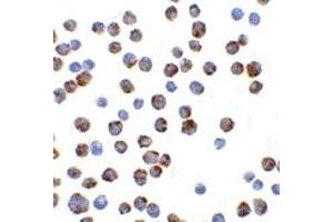 Immunohistochemistry (IHC) image for anti-BCL2-Like 11 (Apoptosis Facilitator) (BCL2L11) (Middle Region 2) antibody (ABIN1031197)