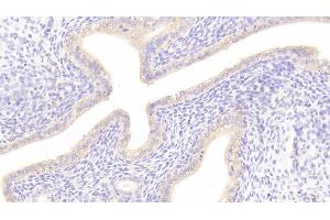 Detection of DKK1 in Rat Uterus Tissue using Polyclonal Antibody to Dickkopf Related Protein 1 (DKK1)