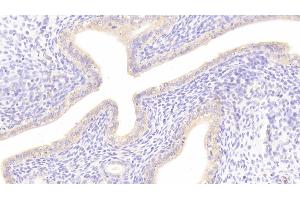 Detection of DKK1 in Rat Uterus Tissue using Polyclonal Antibody to Dickkopf Related Protein 1 (DKK1) (DKK1 anticorps  (AA 36-260))
