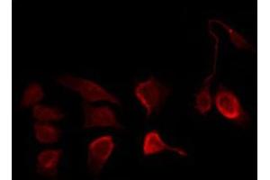 ABIN6267227 staining COS7 by IF/ICC.