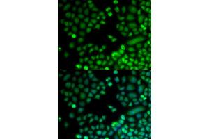 Immunofluorescence analysis of MCF-7 cells using RAD9A antibody.