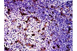 Immunohistochemical analysis of paraffin-embedded tonsil tissues using LPlunc1 mouse mAb with DAB staining.