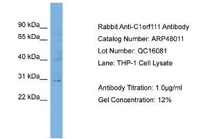 WB Suggested Anti-C1orf111  Antibody Titration: 0. (C1ORF111 anticorps  (N-Term))