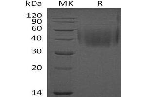 Western Blotting (WB) image for Natural Killer Cell Receptor 2B4 (CD244) protein (His tag) (ABIN7320652)