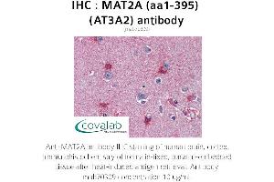 Image no. 1 for anti-Methionine Adenosyltransferase II, alpha (MAT2A) (AA 1-395) antibody (ABIN1724355) (MAT2A anticorps  (AA 1-395))