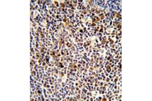 Formalin-fixed and paraffin-embedded human tonsil reacted with KIR3DL3 Antibody (Center) followed which was peroxidase conjugated to the secondary antibody, followed by DAB staining.